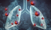 Unhealthy Lung Factors